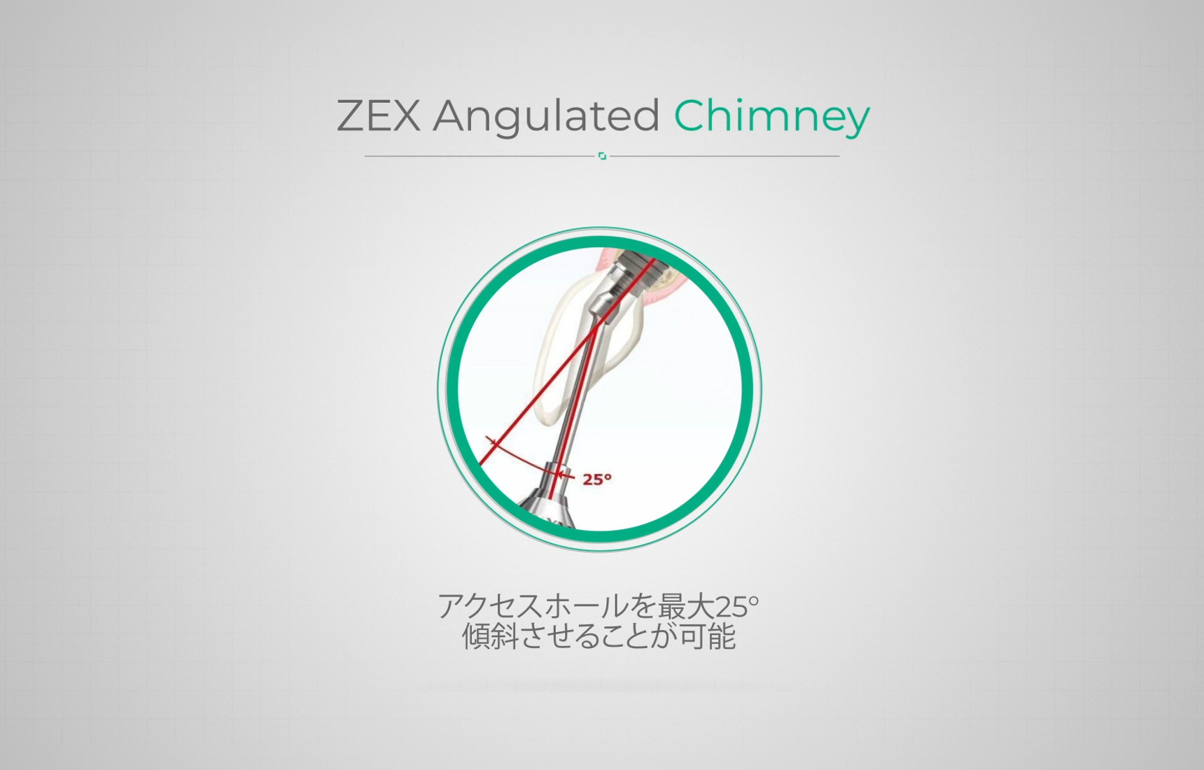 ZAC（ZEX Angulated Chimney）